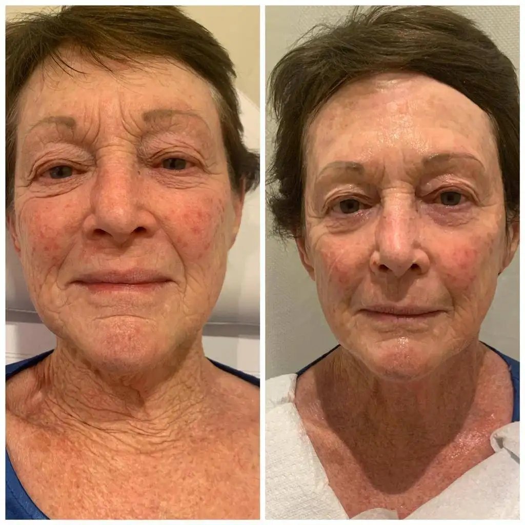 Home - awarenessspa.com (5)